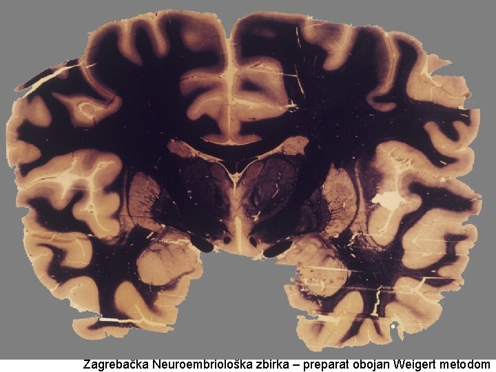 Zagrebačka Neuroembriološka zbirka – preparat obojan Weigert metodom 