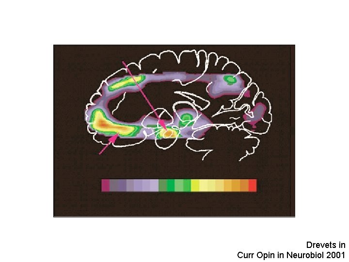 Drevets in Curr Opin in Neurobiol 2001 
