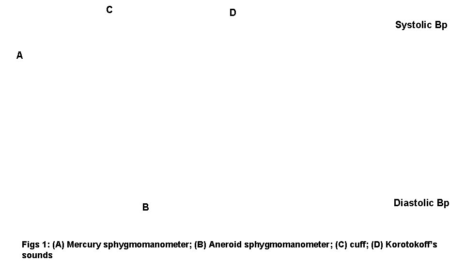 C D Systolic Bp A B Diastolic Bp Figs 1: (A) Mercury sphygmomanometer; (B)