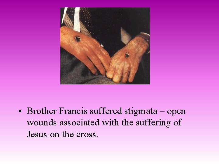  • Brother Francis suffered stigmata – open wounds associated with the suffering of