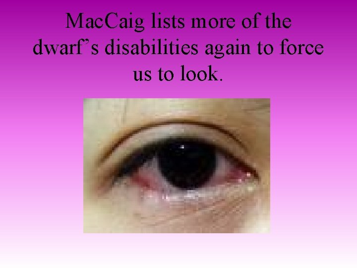Mac. Caig lists more of the dwarf’s disabilities again to force us to look.