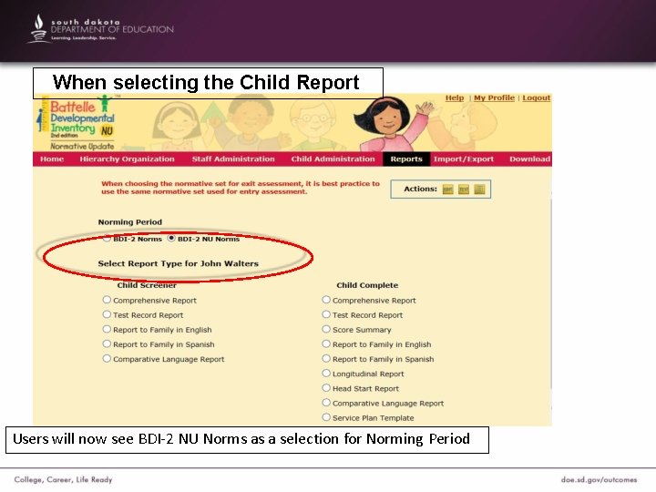 When selecting the Child Report Users will now see BDI-2 NU Norms as a