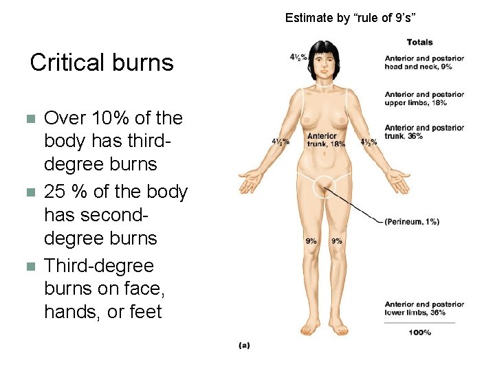 Estimate by “rule of 9’s” Critical burns n n n Over 10% of the