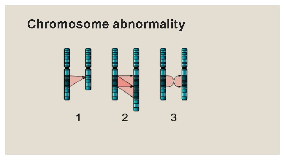 Chromosome abnormality 