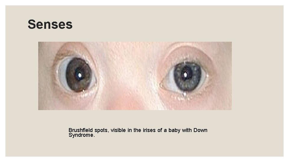 Senses Brushfield spots, visible in the irises of a baby with Down Syndrome. 