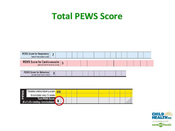 Total PEWS Score 2 3 3 00 8 Total PEWS Score 2 3 3 00 8