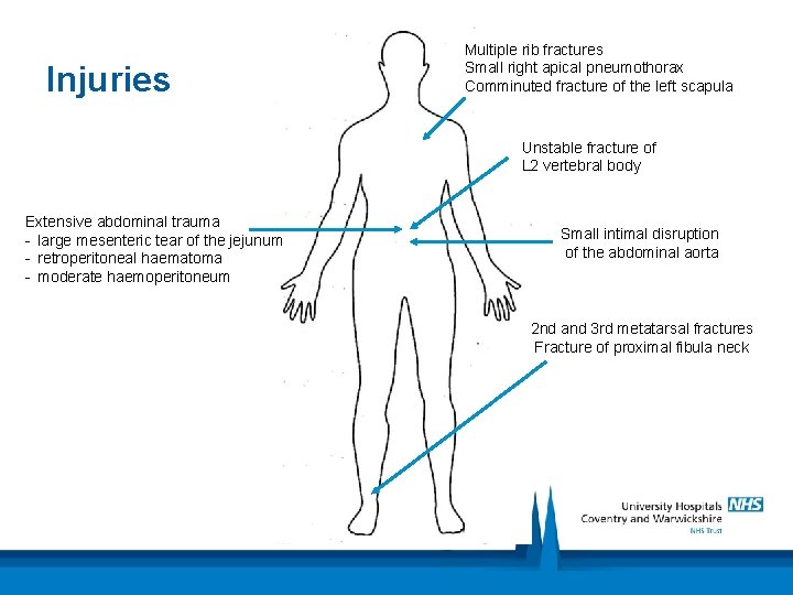 Injuries Multiple rib fractures Small right apical pneumothorax Comminuted fracture of the left scapula