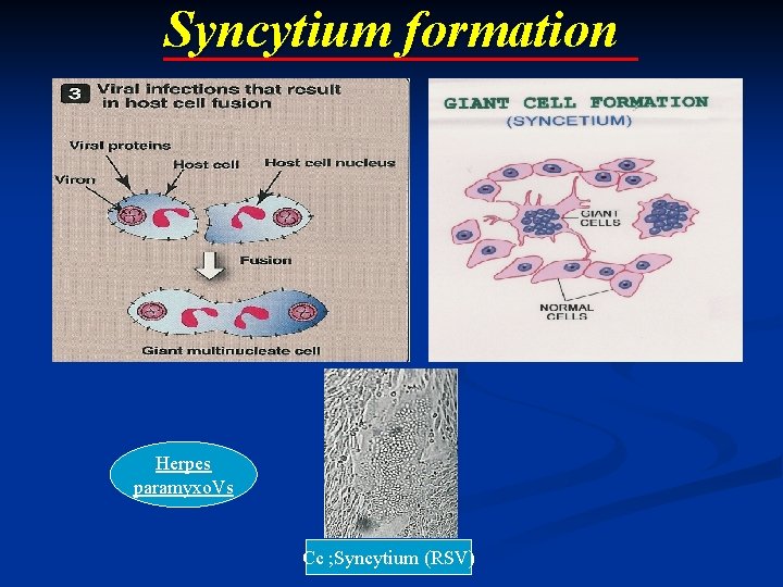 Syncytium formation Herpes paramyxo. Vs Cc ; Syncytium (RSV) Syncytium formation Herpes paramyxo. Vs Cc ; Syncytium (RSV)