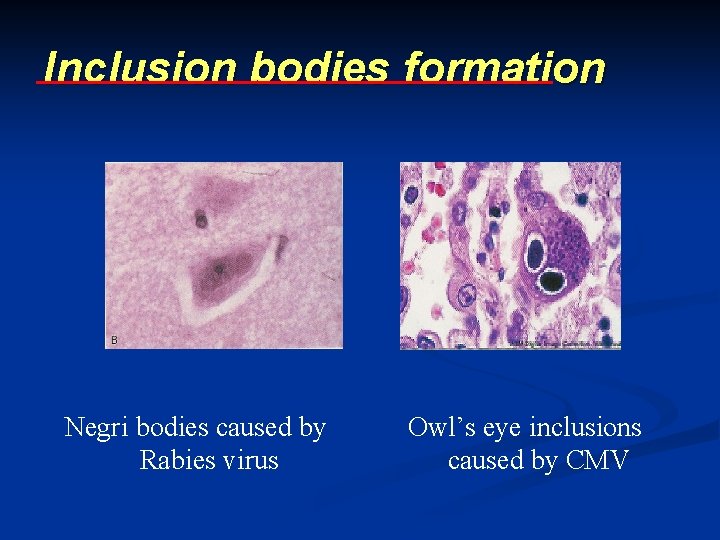 Inclusion bodies formation Negri bodies caused by Rabies virus Owl’s eye inclusions caused by Inclusion bodies formation Negri bodies caused by Rabies virus Owl’s eye inclusions caused by