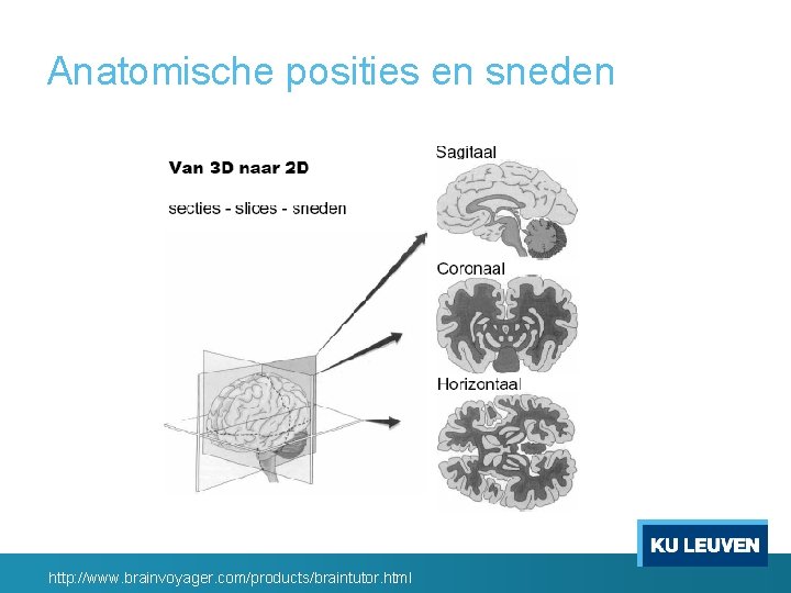 Anatomische posities en sneden http: //www. brainvoyager. com/products/braintutor. html 
