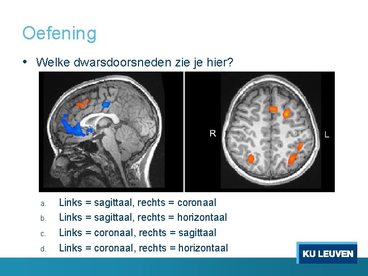 Oefening • Welke dwarsdoorsneden zie je hier? a. b. c. d. Links = sagittaal,