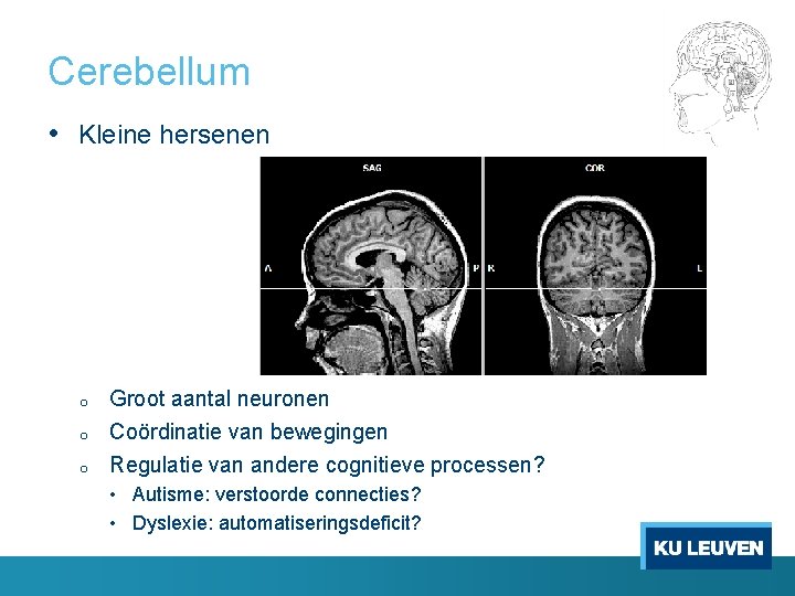 Cerebellum • Kleine hersenen o o o Groot aantal neuronen Coördinatie van bewegingen Regulatie