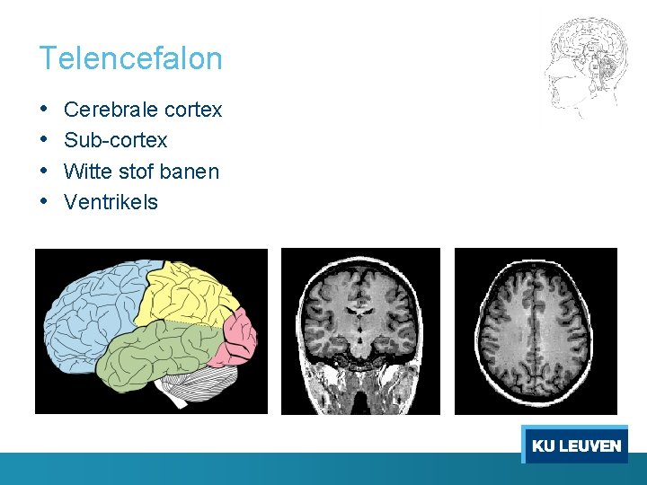 Telencefalon • • Cerebrale cortex Sub-cortex Witte stof banen Ventrikels 