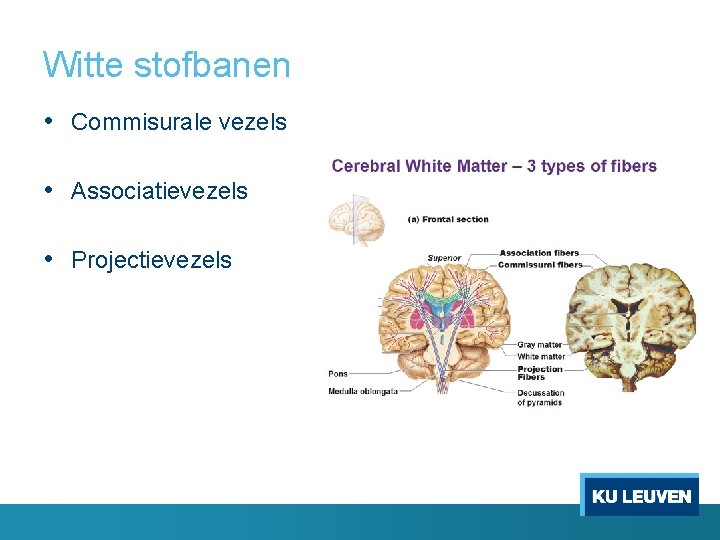 Witte stofbanen • Commisurale vezels • Associatievezels • Projectievezels 