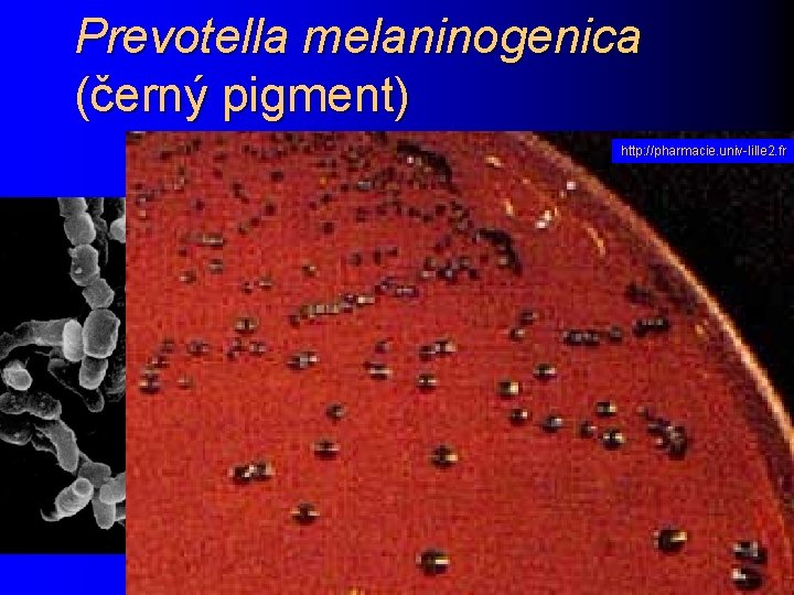 Prevotella melaninogenica (černý pigment) http: //pharmacie. univ-lille 2. fr 