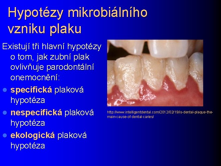 Hypotézy mikrobiálního vzniku plaku Existují tři hlavní hypotézy o tom, jak zubní plak ovlivňuje