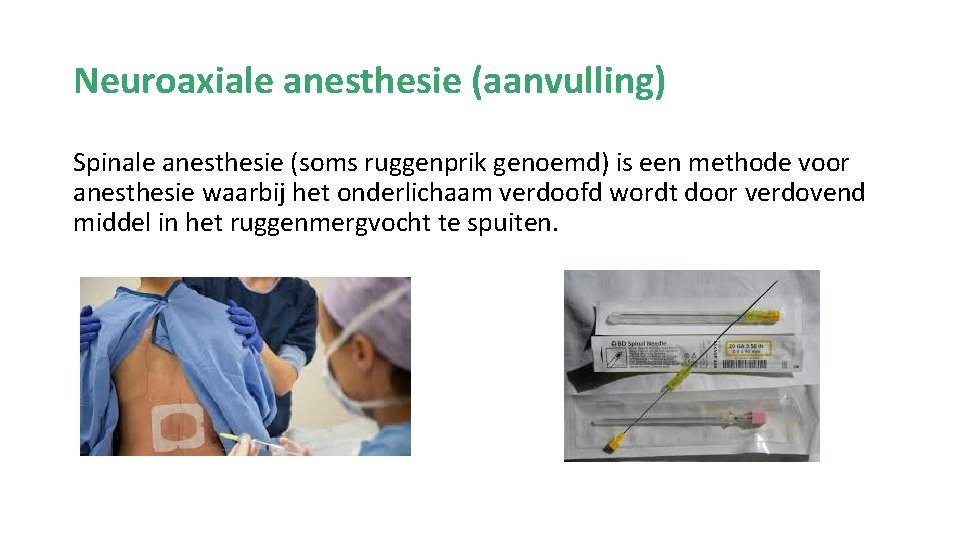 Neuroaxiale anesthesie (aanvulling) Spinale anesthesie (soms ruggenprik genoemd) is een methode voor anesthesie waarbij