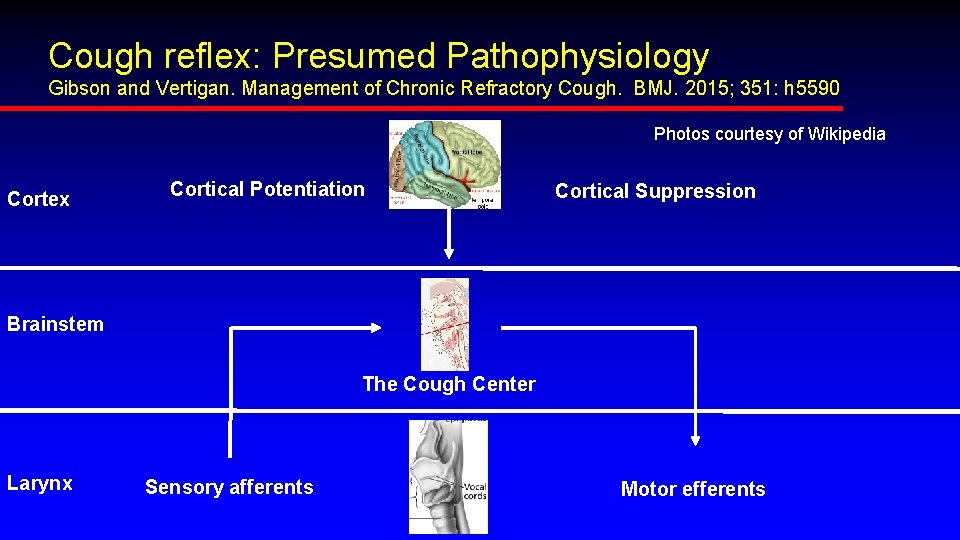 Cough reflex: Presumed Pathophysiology Gibson and Vertigan. Management of Chronic Refractory Cough. BMJ. 2015;