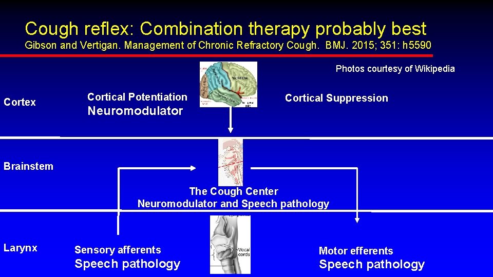 Cough reflex: Combination therapy probably best Gibson and Vertigan. Management of Chronic Refractory Cough.