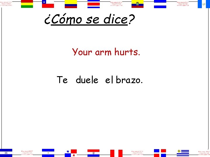 ¿Cómo se dice? Your arm hurts. Te duele el brazo. 