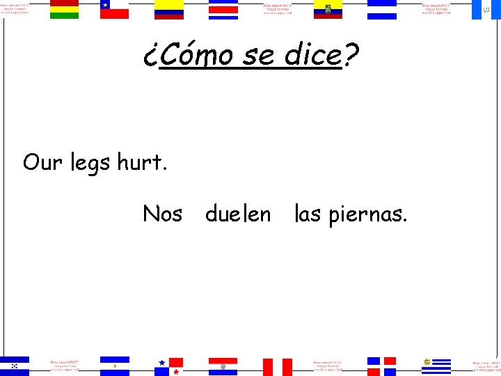 ¿Cómo se dice? Our legs hurt. Nos duelen las piernas. 
