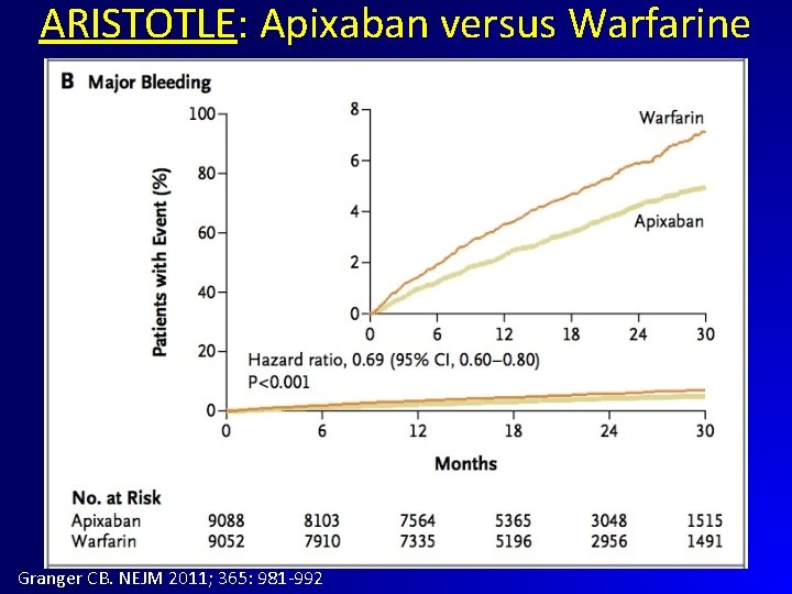 ARISTOTLE: Apixaban versus Warfarine Granger CB. NEJM 2011; 365: 981 -992 