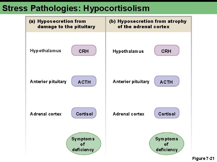 Stress Pathologies: Hypocortisolism (a) Hyposecretion from damage to the pituitary (b) Hyposecretion from atrophy