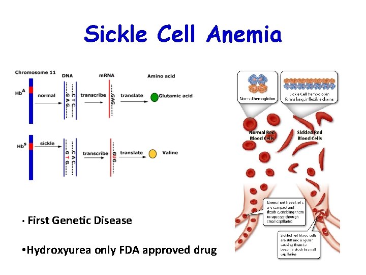 Sickle Cell Anemia • First Genetic Disease • Hydroxyurea only FDA approved drug 