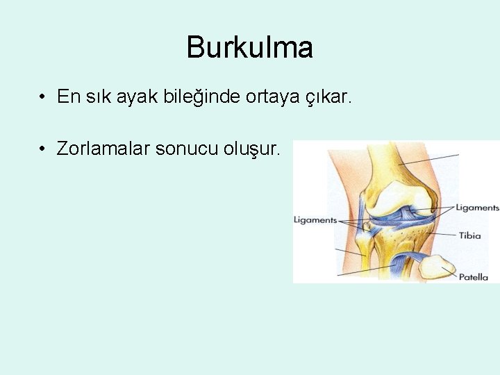 Burkulma • En sık ayak bileğinde ortaya çıkar. • Zorlamalar sonucu oluşur. 