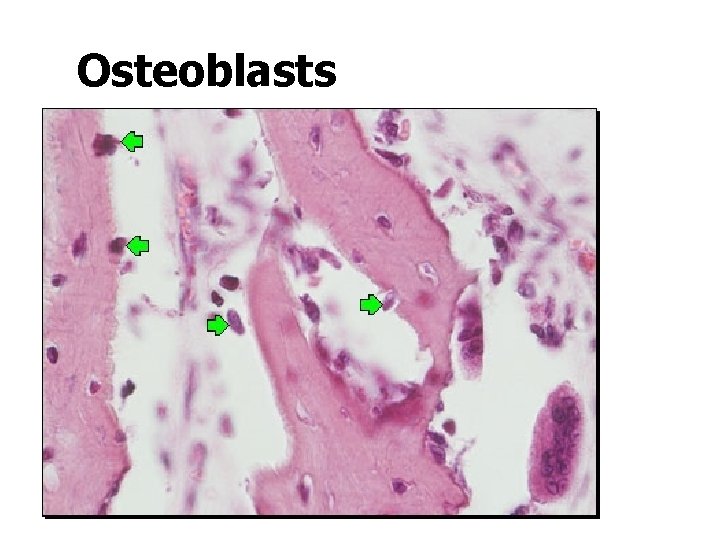 Osteoblasts 