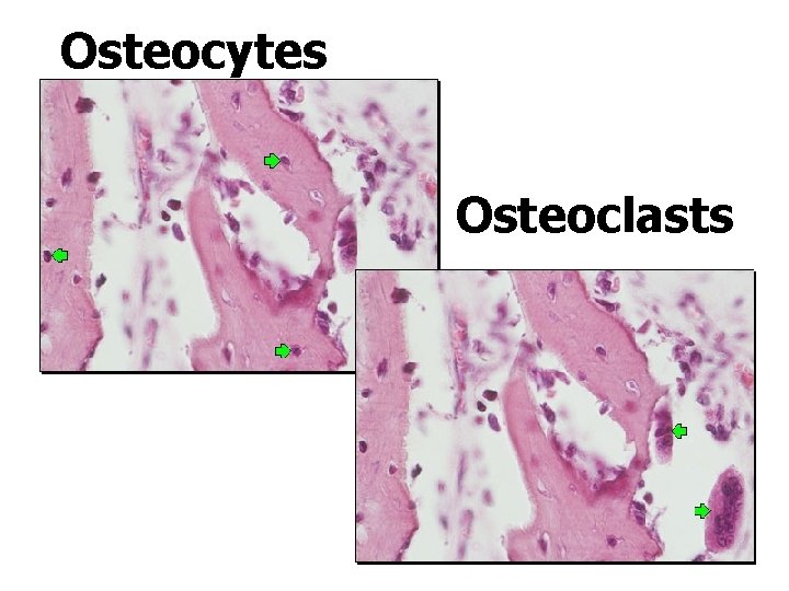 Osteocytes Osteoclasts 