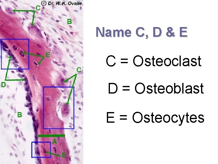 Name C, D & E C = Osteoclast D = Osteoblast E = Osteocytes