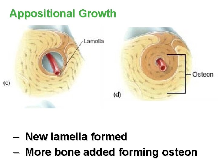 Appositional Growth – New lamella formed – More bone added forming osteon 