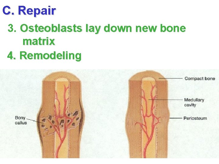 C. Repair 3. Osteoblasts lay down new bone matrix 4. Remodeling 