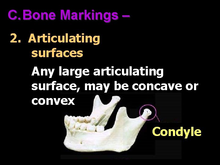C. Bone Markings – 2. Articulating surfaces Any large articulating surface, may be concave