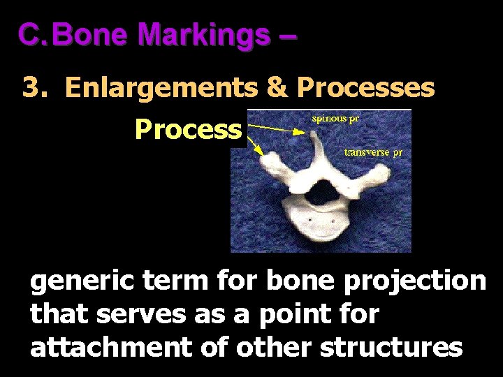 C. Bone Markings – 3. Enlargements & Processes Process generic term for bone projection