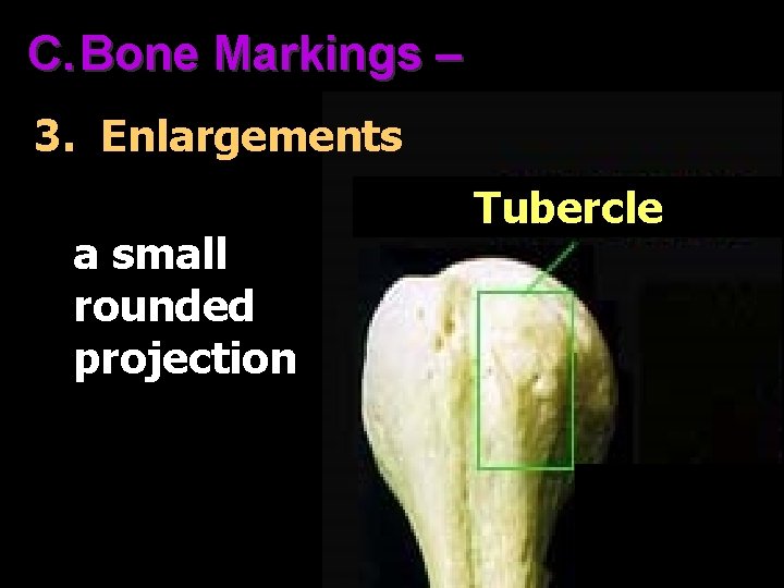 C. Bone Markings – 3. Enlargements a small rounded projection Tubercle 