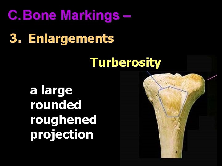 C. Bone Markings – 3. Enlargements Turberosity a large rounded roughened projection 