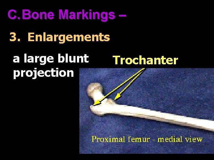 C. Bone Markings – 3. Enlargements a large blunt projection Trochanter 