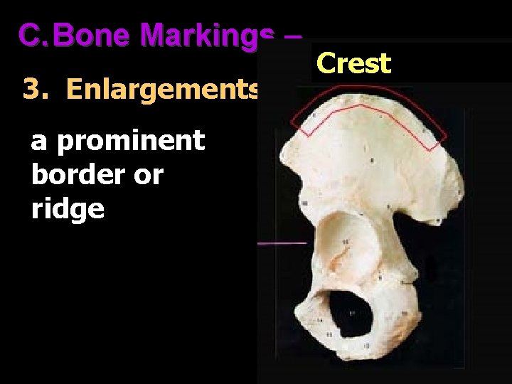 C. Bone Markings – 3. Enlargements a prominent border or ridge Crest 