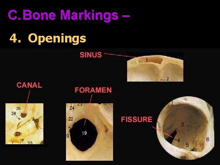 C. Bone Markings – 4. Openings 