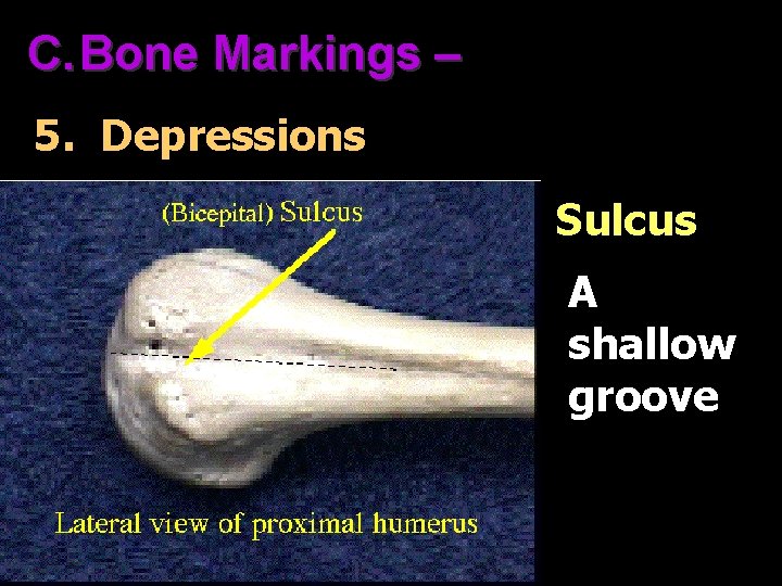 C. Bone Markings – 5. Depressions Sulcus A shallow groove 