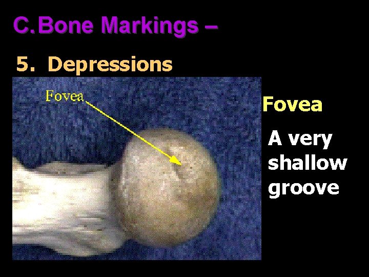 C. Bone Markings – 5. Depressions Fovea A very shallow groove 