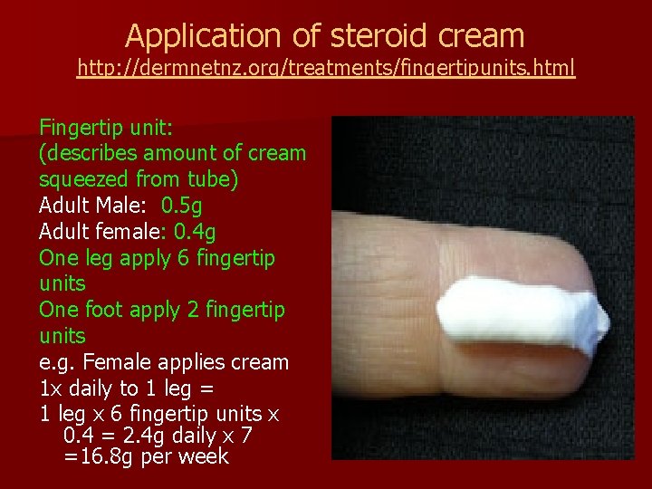 Application of steroid cream http: //dermnetnz. org/treatments/fingertipunits. html Fingertip unit: (describes amount of cream
