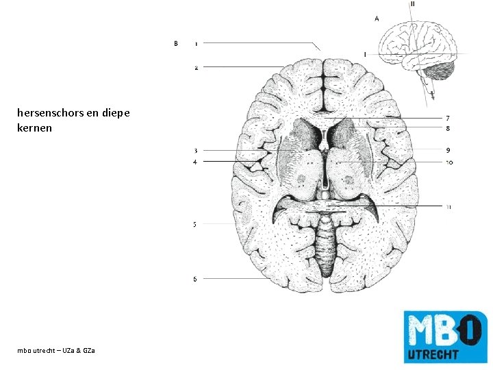 hersenschors en diepe kernen mbo utrecht – UZa & GZa de titel van de