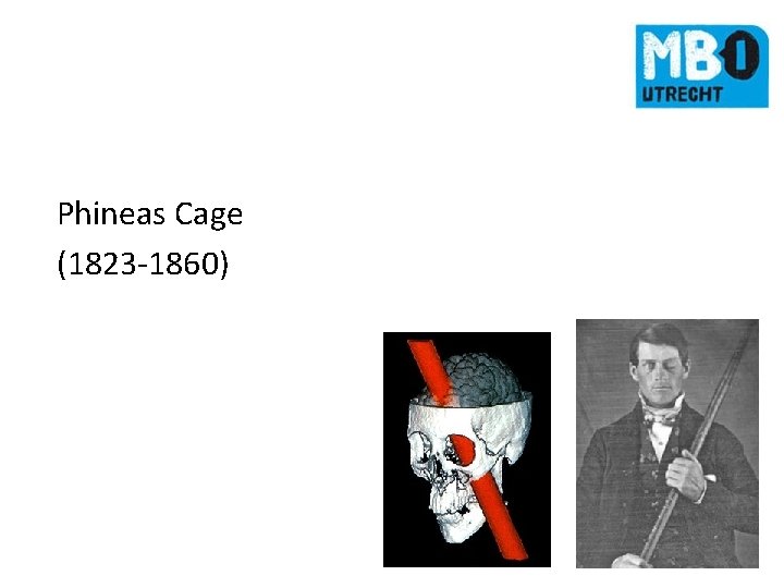 Phineas Cage (1823 -1860) 