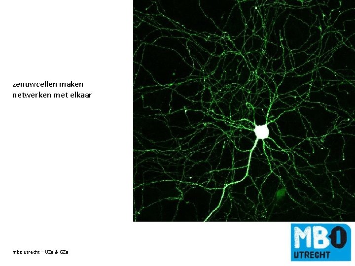 zenuwcellen maken netwerken met elkaar mbo utrecht – UZa & GZa de titel van