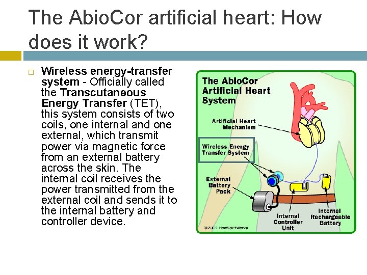 The Abio. Cor artificial heart: How does it work? Wireless energy-transfer system - Officially