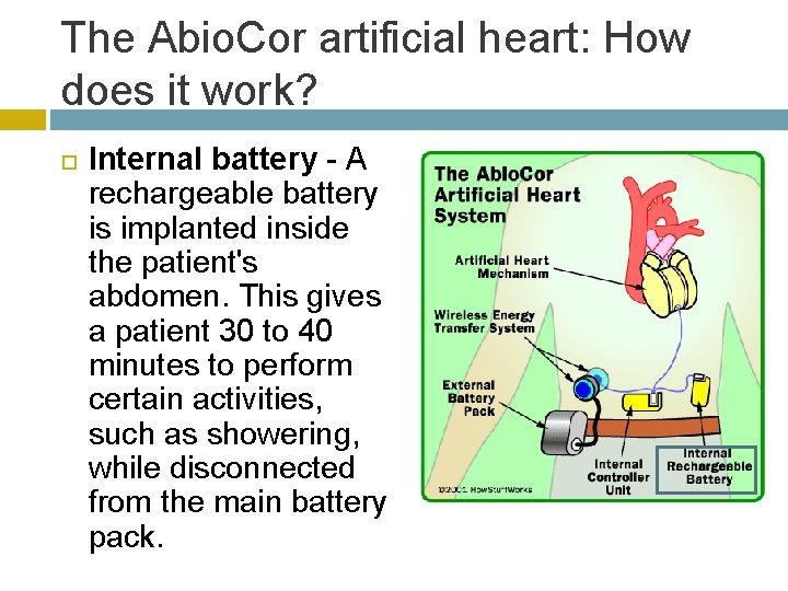The Abio. Cor artificial heart: How does it work? Internal battery - A rechargeable