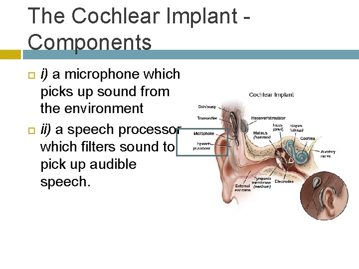 The Cochlear Implant Components i) a microphone which picks up sound from the environment